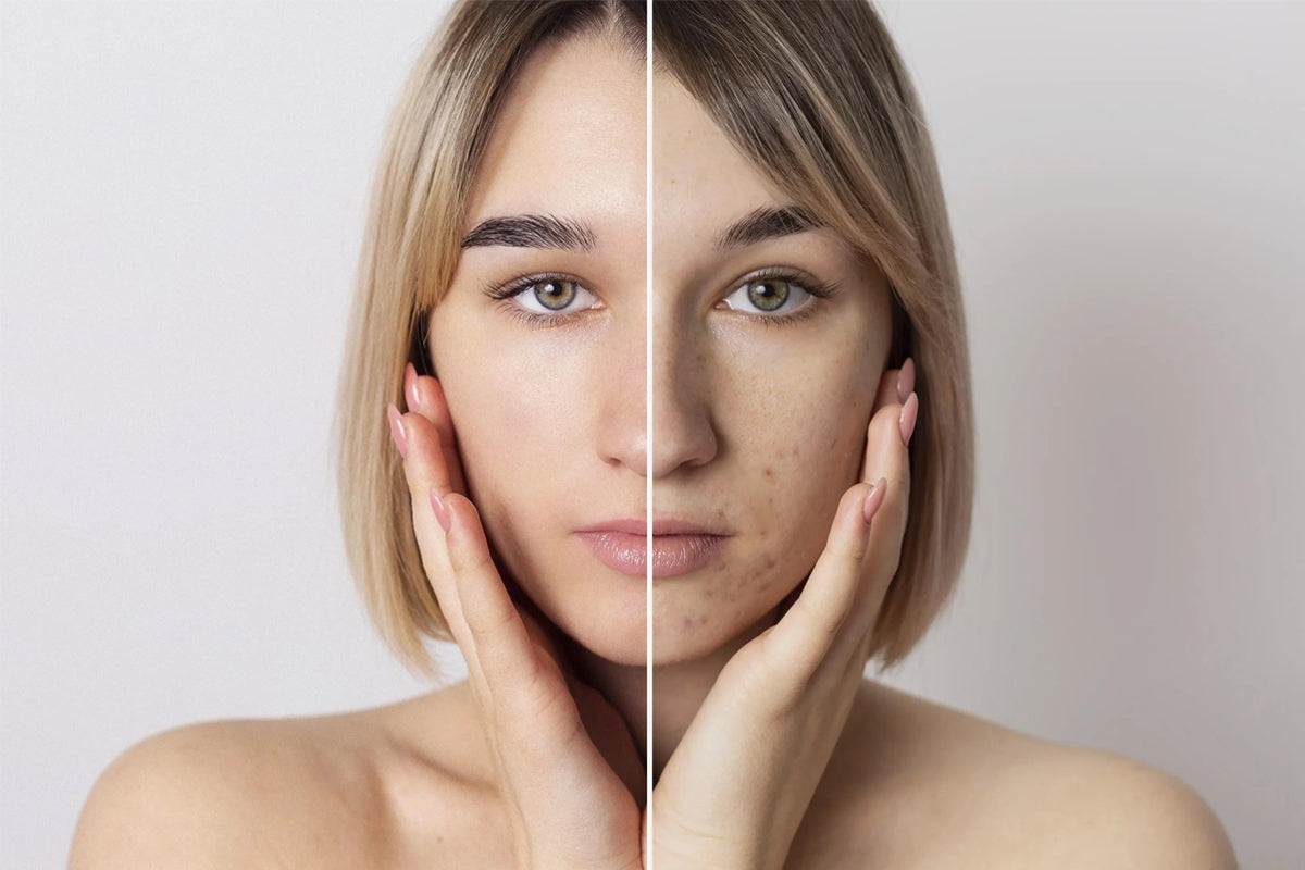 Cara Mengatasi Kulit Kusam dengan Collagen