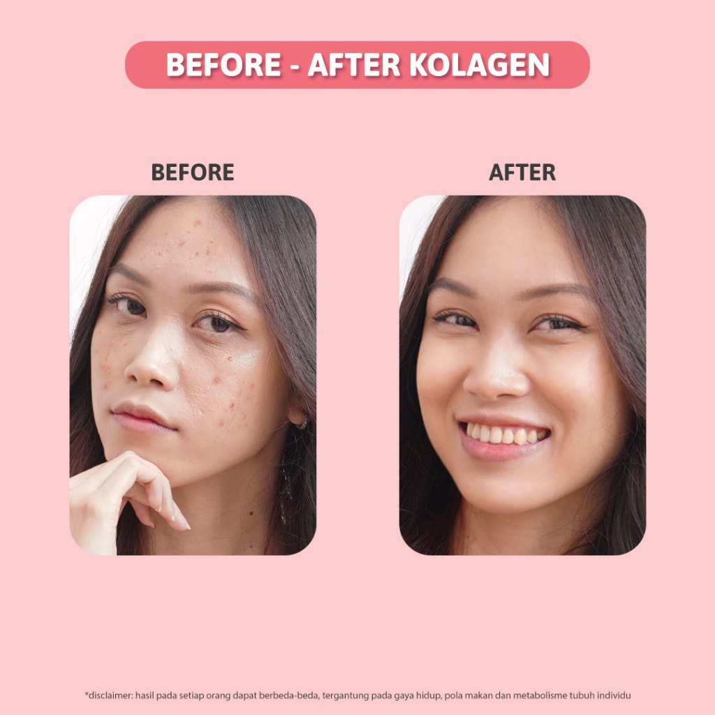 Beauty Collagen Healthy Skin 20s Peach Flavor 1 Tube